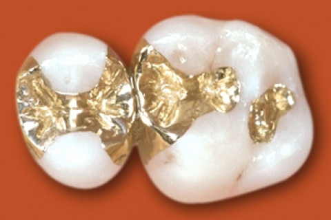 Goldinlay